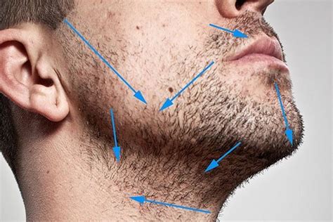 Rasage Et Bouton 6 Conseils Pour Vous Coucher Moins Cn Skin Campus
