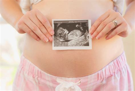 The nt scan is an ultrasound done in the first trimester to determine your baby's risk of having down syndrome and some other chromosomal abnormalities. Nuchal translucency: NT scans and what they mean ...