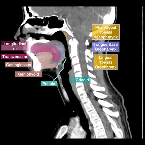 Ct Neck With Annotated Scrollable Images Image