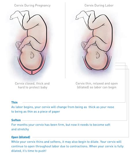 Why Is My Cervix So Hard How To Feel Your Cervix 9 Steps With Pictures