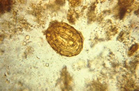 public domain picture this photomicrograph depicts a fertilized egg of the parasite ascaris