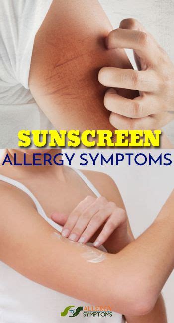 Sunscreen Allergy Symptoms Sunscreen Allergy Allergy Symptoms