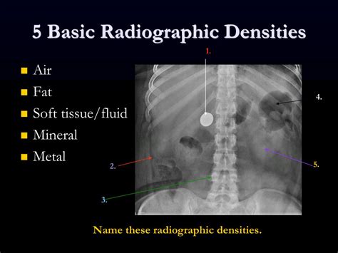 Ppt Introduction To Medical Imaging Powerpoint Presentation Free