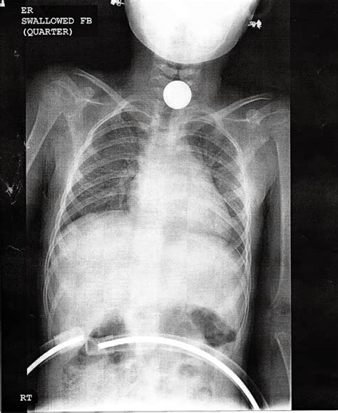 Crazy X Ray Pictures
