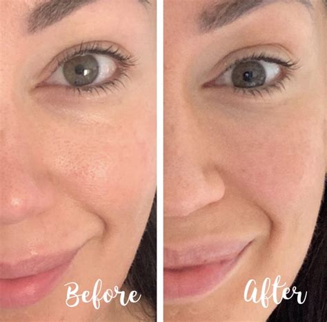 How I Improved My Skin In 28 Days With Olay Retinol24 And How I