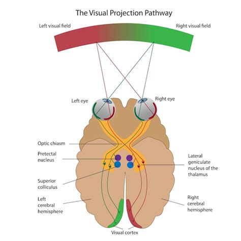 Visual Projection Pathway Pediatric Ophthalmology Pa