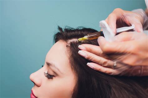 Prp Hair Loss Treatment For Women Melbourne Fl Brevard County