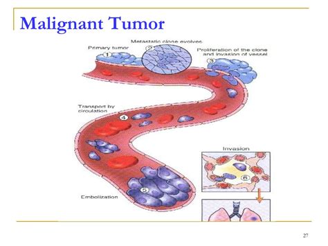 Ppt Neoplasia Powerpoint Presentation Free Download Id9439735