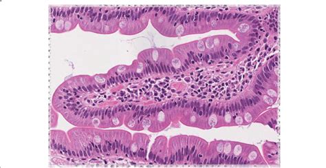 Duodenal Mucosa Showing A Normal Histologic Appearance With Normal