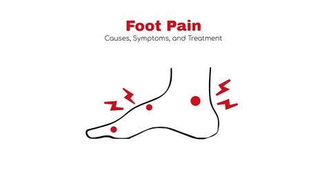 Foot Pain Causes Symptoms And Treatment ~ Statcardiologist