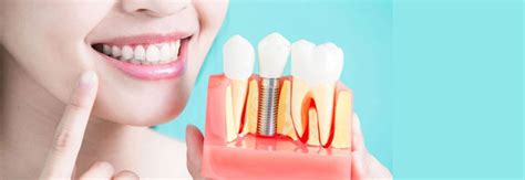 Everything You Need To Know Before Getting Dental Implants In Sydney