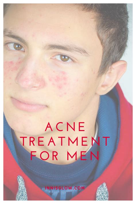 Pin On How To Get Rid Of Acne