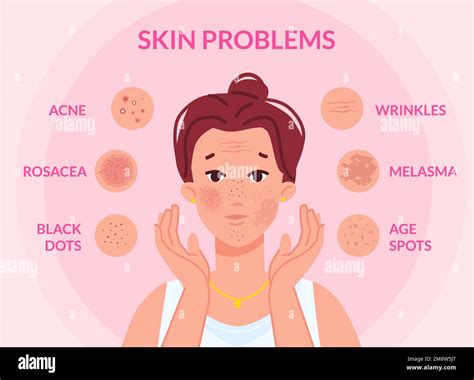 Types Skin Problems Woman Face With Skins Troubles Melasma Pimple