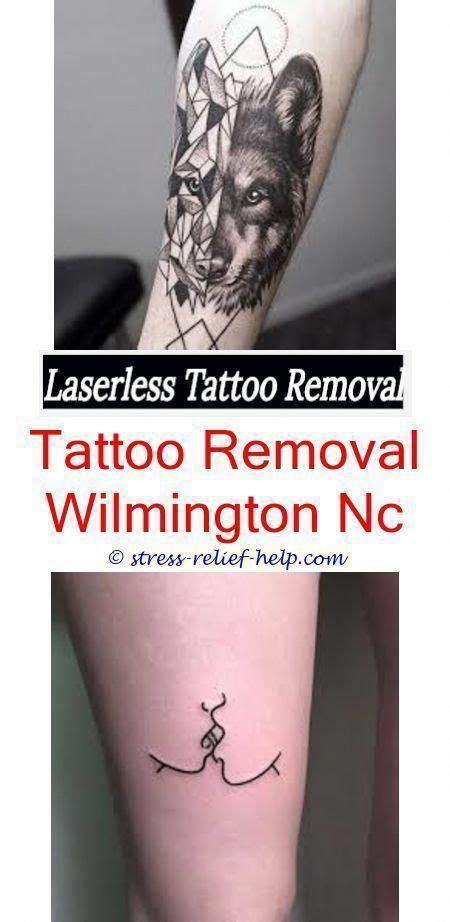 June 29 at 3:49 am · bristol, united kingdom ·. laser tattoo removal results does tattoo removal hurt more - how well do tattoo removals work ...
