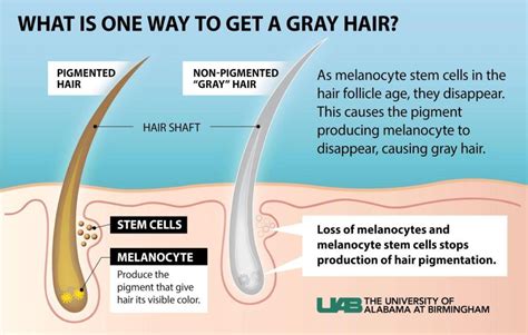 Causes And Solutions For Gray Hair