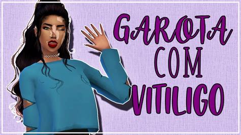 Garota Com Vitiligo Create A Sim The Sims 4 Download Youtube