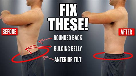 Fix Lower Back Posture Fast Exercises For Pelvic Tilt Part 2 Youtube