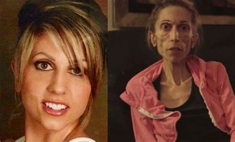 watch woman with anorexia makes public appeal to save her life