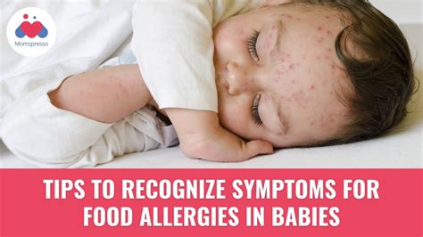 Tips On Food Allergies In Babies Symptoms Of Food Allergies In