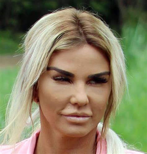 Katie Prices Post Surgery Face Revealed As She Compares Herself To An Alien Irish Mirror Online