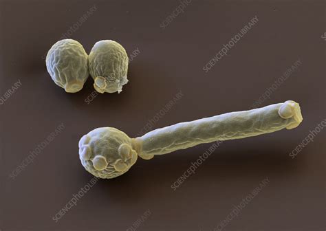 Candida Albicans Fungus Sem Stock Image C0459635 Science Photo