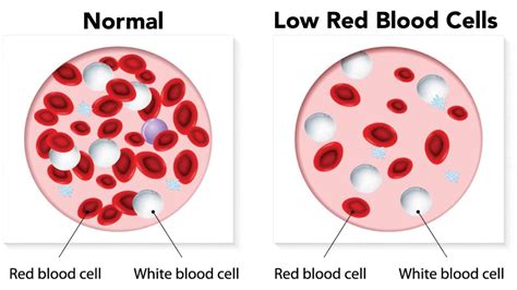 The granulocytes, which include neutrophils, eosinophils, and basophils, have granules in their cell cytoplasm. 5 Signs You Have A Low Red Blood Cell Count