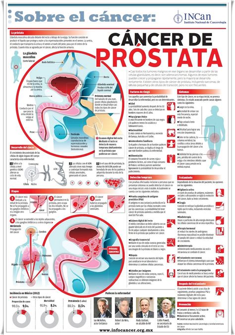 Infografía Completa Sobre El Cáncer De Próstata  1269×1814 Ca De