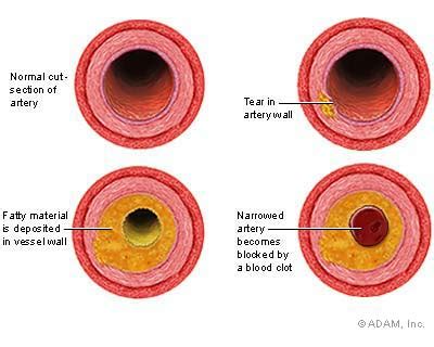 The New York Times Health Image Developmental Process Of