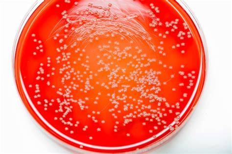 Premium Photo Bacterial Colonies Culture On Blood Agar In Microbiology