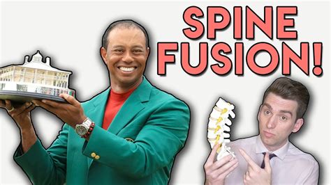 Tiger Woods Spine Fusion Explained By Doctor Youtube