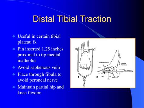 Ppt Orthopaedic Traction Powerpoint Presentation Free Download Id