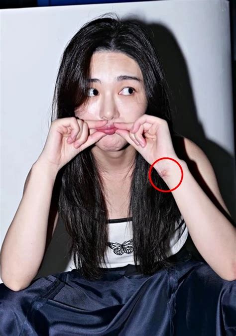 Kwon min ah, better known as mina, is a south korean singer and actress. Internautas preocupados por nuevas cicatrices en las ...