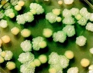 Pseudomonas infection causes and risk factors. Adapting To Clogged Airways Makes Common Pathogen Resist Powerful Antibiotics - Even Without ...