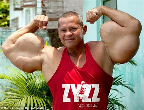 Brazilian Bodybuilder Grows 29 Inch Fake Biceps