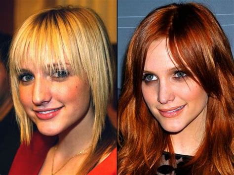 Celebrities Before And After A Plastic Surgery 21 Pics