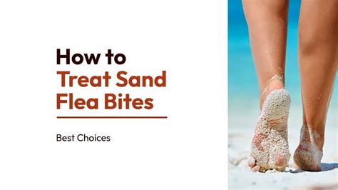 How To Treat Sand Flea Bites Soothe Itchy Irritated Skin Fast Best