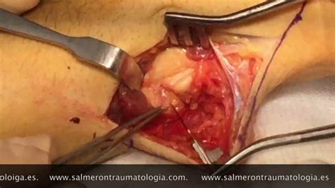 Simple Science: How to Make a Volcano with Kids