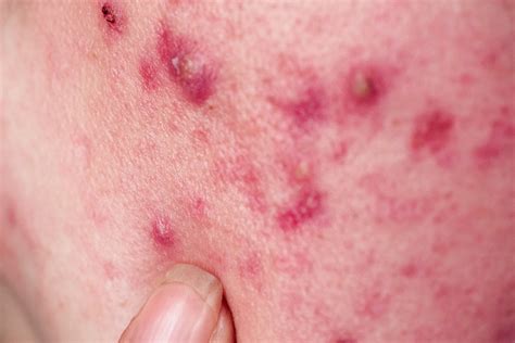 5 Common Skin Concerns Sokörpe Laboratories — Sokörpe