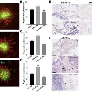 Mir A Decreases Teer And Increases The Motility Potential Of Huvec