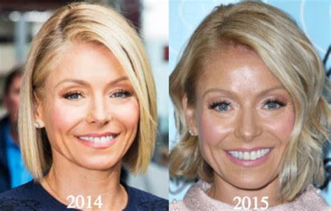 Kelly Ripa Plastic Surgery Before And After Photos