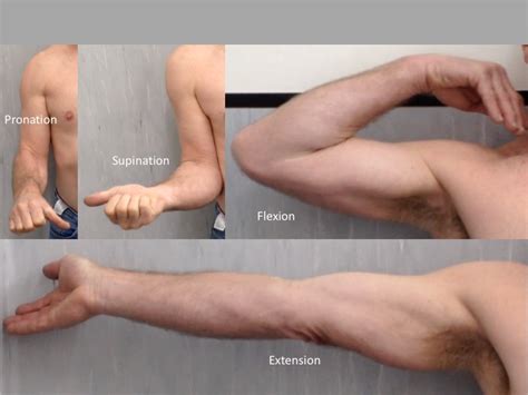 Postoperative Distal Biceps Tendon Repair Rehabilitation Protocol Hot Sex Picture