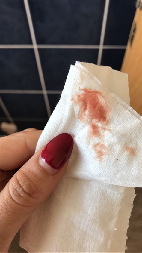 7 weeks bleeding spotting help netmums chat