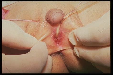 Inserting Penis Into Vagina Porn Pics Sex Photos XXX Images