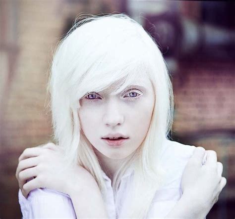 The Most Beautiful Albino Girl In World Bukge Albino Girl Albino Model Beautiful Albino