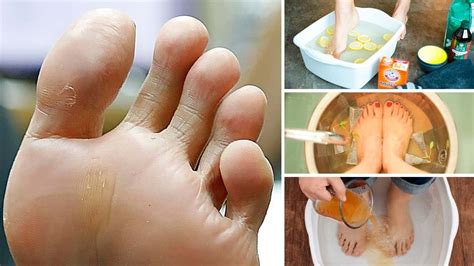 How To Get Rid Of Smelly Feet Permanently The Leathers Point