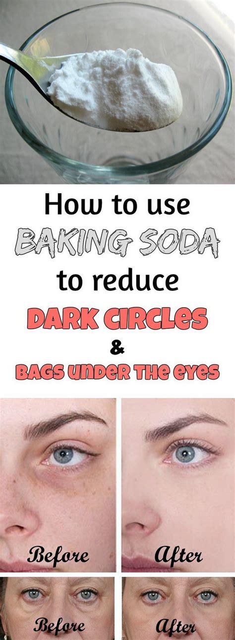 15 Ways To Get Rid Of Dark Circles Under Your Eyes Hative