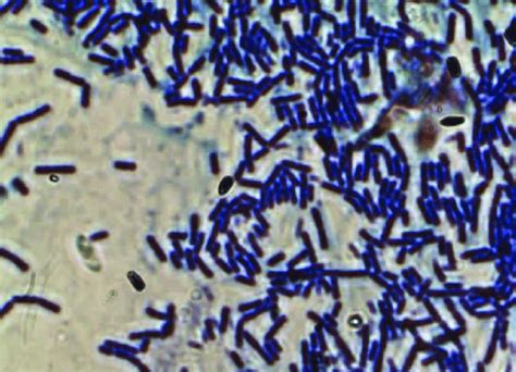 Spore Stained Bacillus Subtilis 100 X Magnification Download