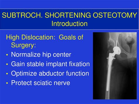 Ppt Shortening Subtrochanteric Osteotomy For High Hip Dislocation