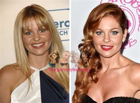 Candace Cameron Plastic Surgery The Truth About The Rumors Candace