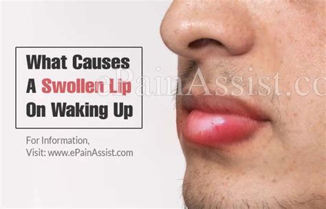What Causes Swollen Lips And Itchy Skin